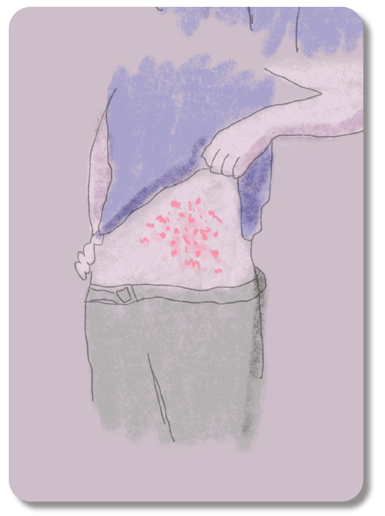 Illustration on a card of a person lifting up their shirt and showing their skin