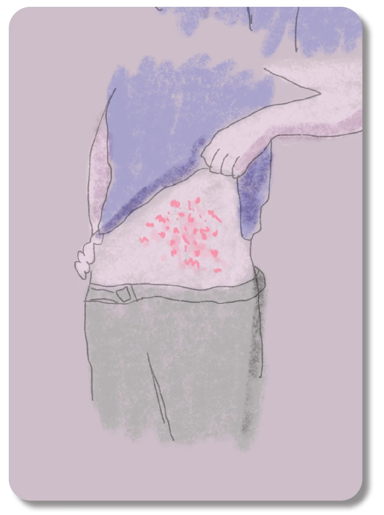 Illustration on a card of a person lifting up their shirt and showing their skin